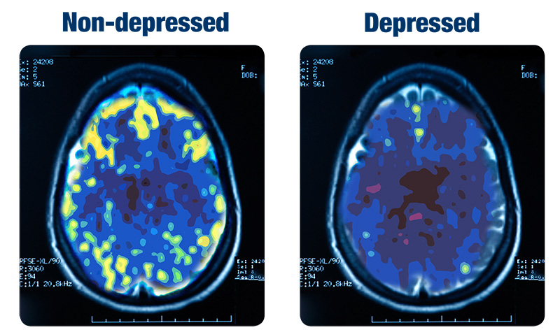 PET-Scan-with-MGeorge-ref